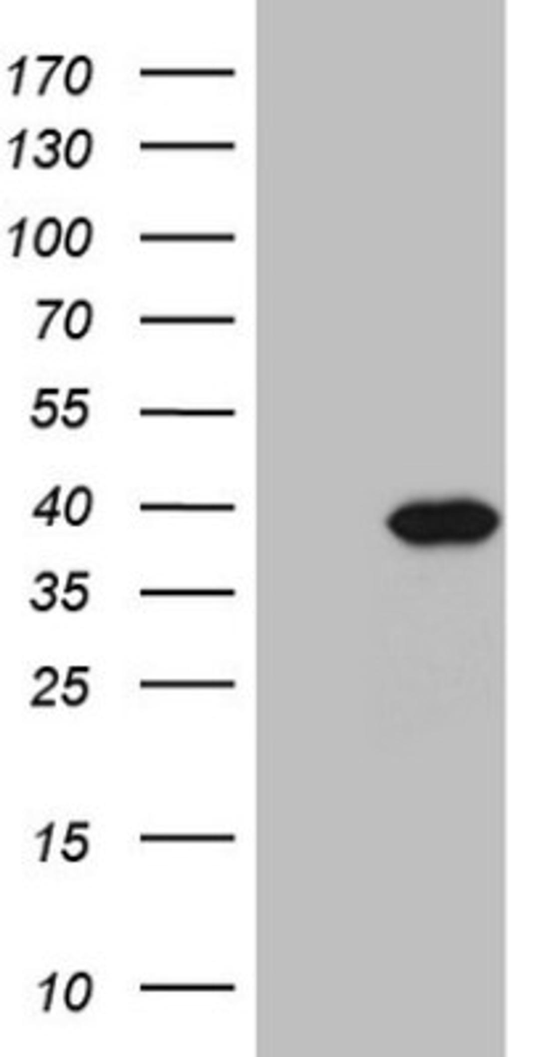 Western Blot: PPA2 Antibody (7C1) [NBP2-45377] - Analysis of HEK293T cells were transfected with the pCMV6-ENTRY control (Left lane) or pCMV6-ENTRY PPA2.