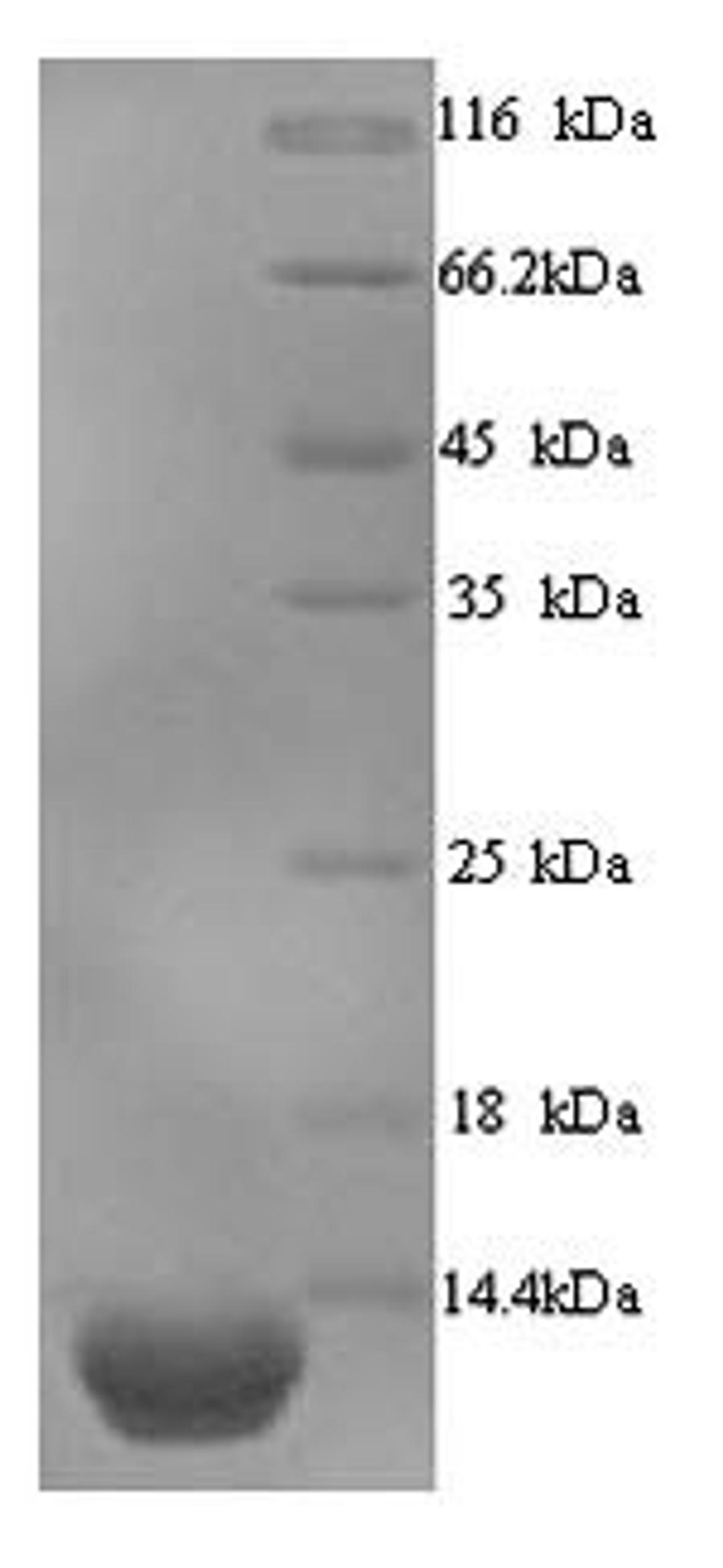 (Tris-Glycine gel) Discontinuous SDS-PAGE (reduced) with 5% enrichment gel and 15% separation gel.
