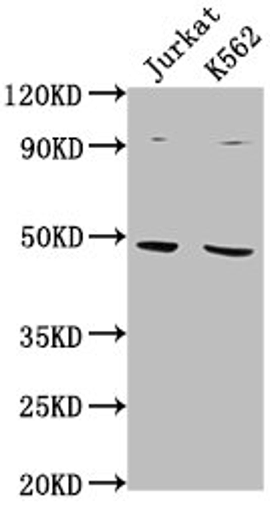 Western Blot. Positive WB detected in: Jurkat whole cell lysate, K562 whole cell lysate. All lanes: PSMD6 antibody at 1:2000. Secondary. Goat polyclonal to rabbit IgG at 1/50000 dilution. Predicted band size: 46, 42, 52 kDa. Observed band size: 46 kDa.