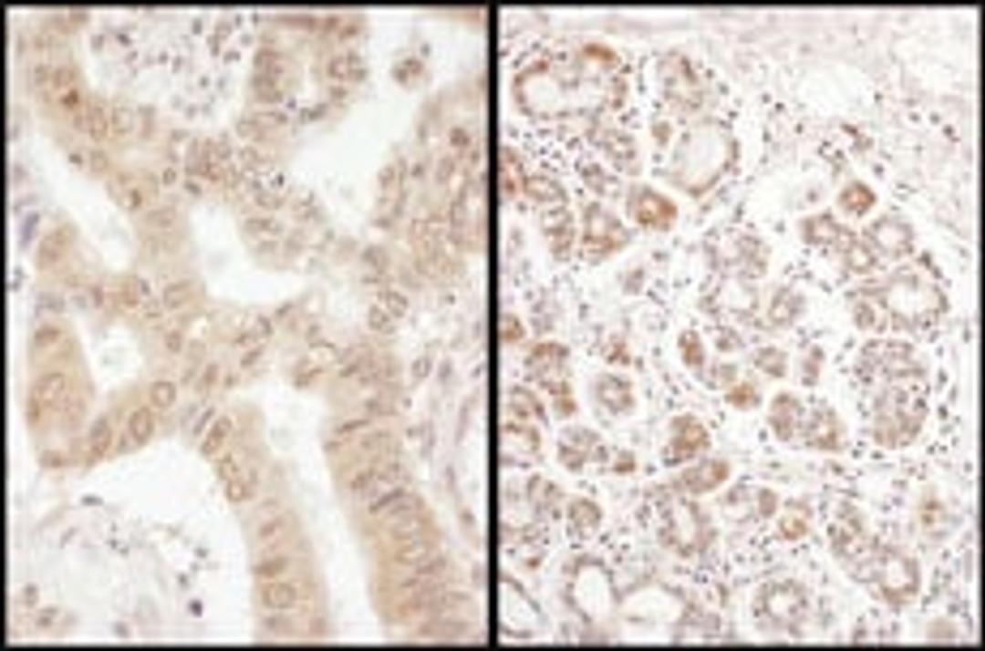 Detection of human eIF2B delta/EIF2B4 by immunohistochemistry.