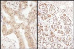 Detection of human eIF2B delta/EIF2B4 by immunohistochemistry.