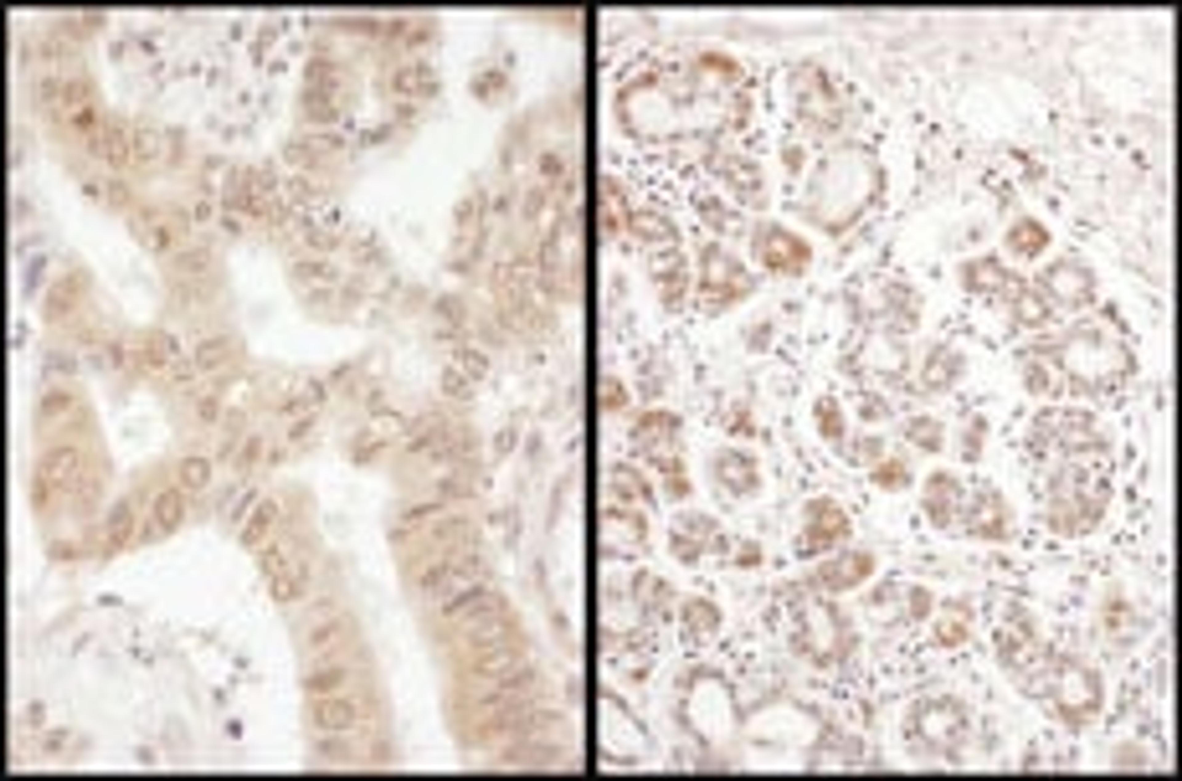 Detection of human eIF2B delta/EIF2B4 by immunohistochemistry.