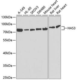 Western blot - HAS3 antibody (A6617)