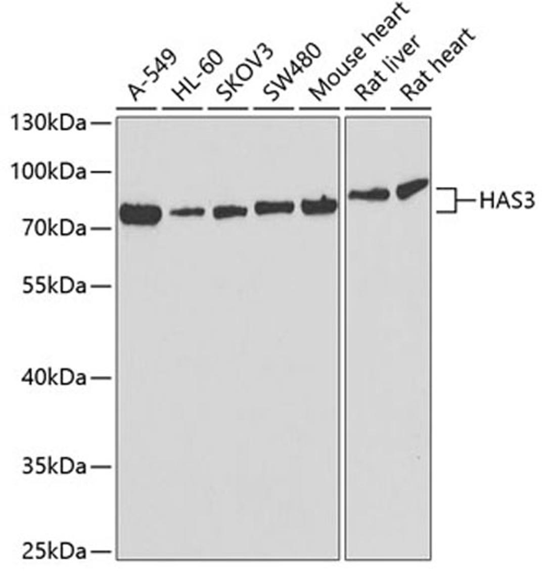 Western blot - HAS3 antibody (A6617)