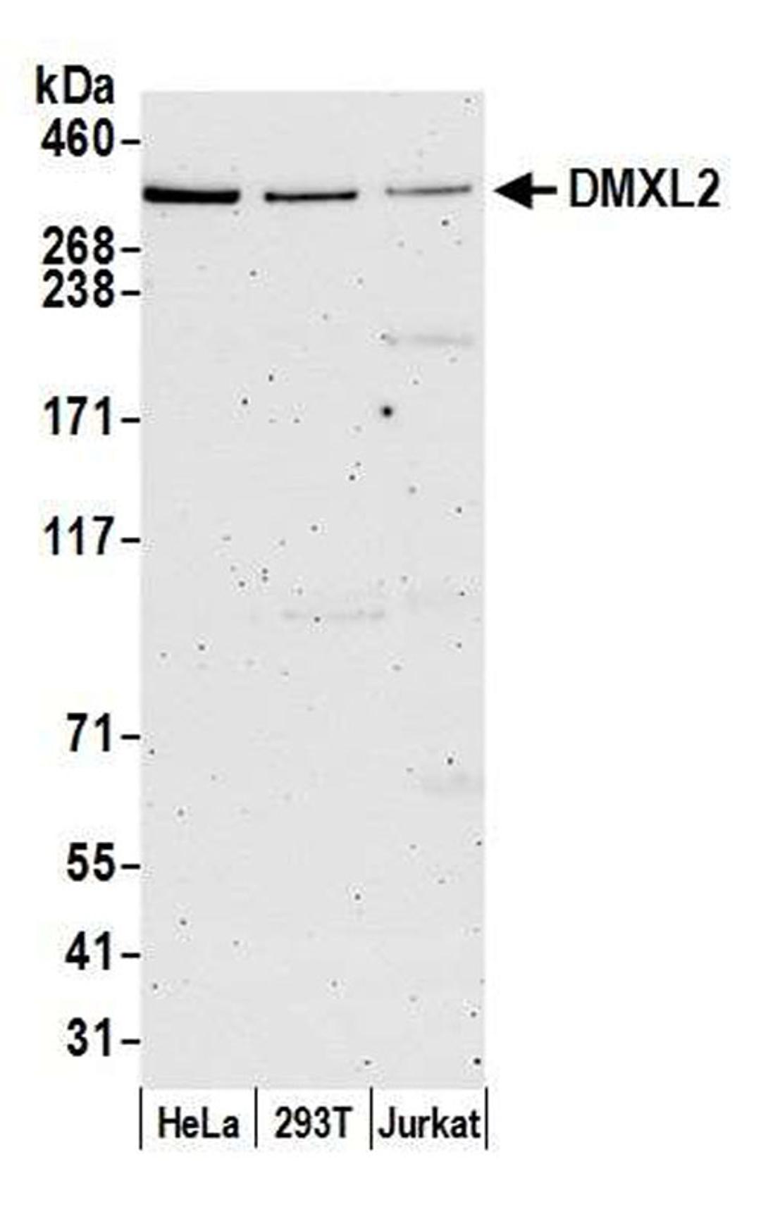 Detection of human DMXL2 by WB.