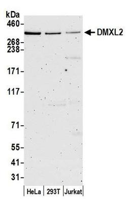 Detection of human DMXL2 by WB.