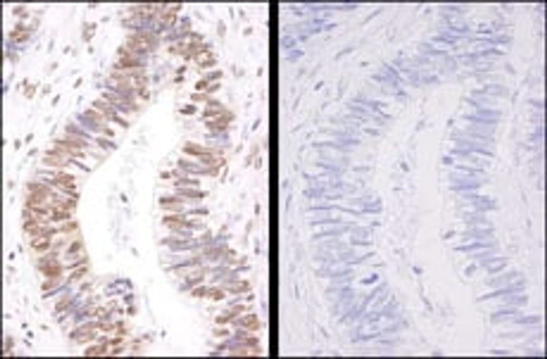 Detection of human Phospho-SMC3 (S1083) by immunohistochemistry.