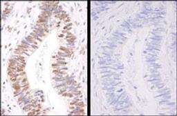 Detection of human Phospho-SMC3 (S1083) by immunohistochemistry.