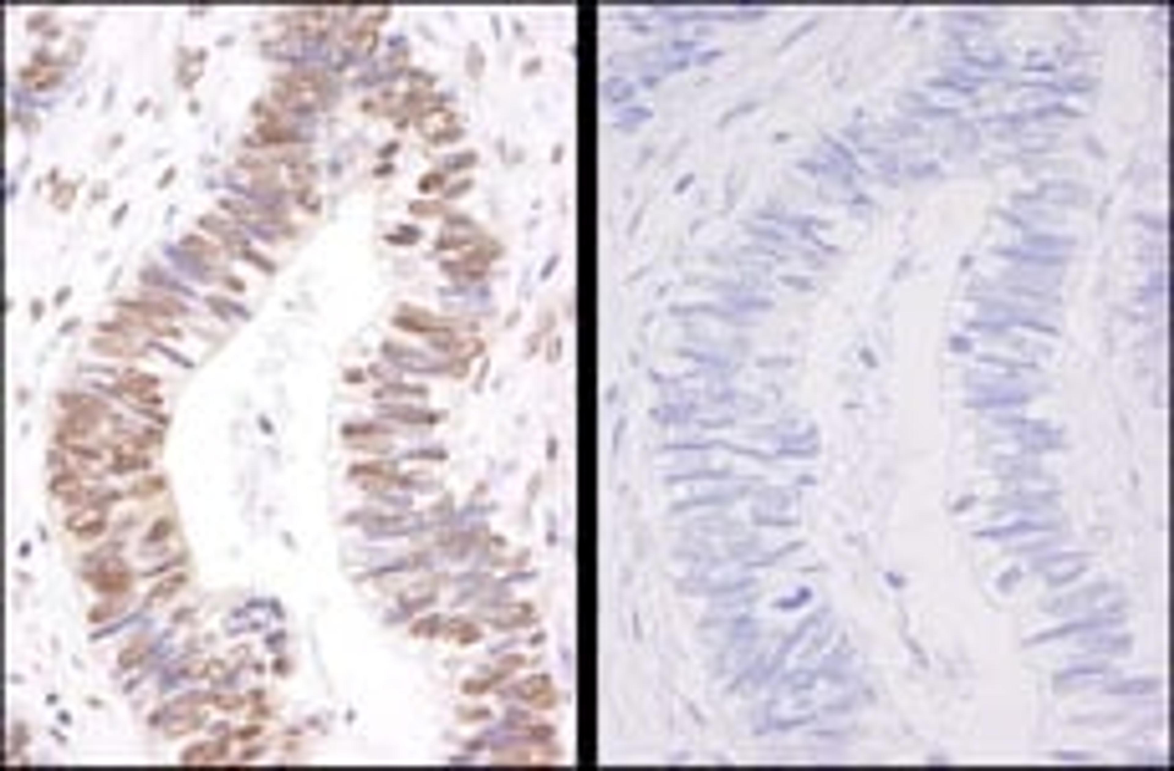 Detection of human Phospho-SMC3 (S1083) by immunohistochemistry.