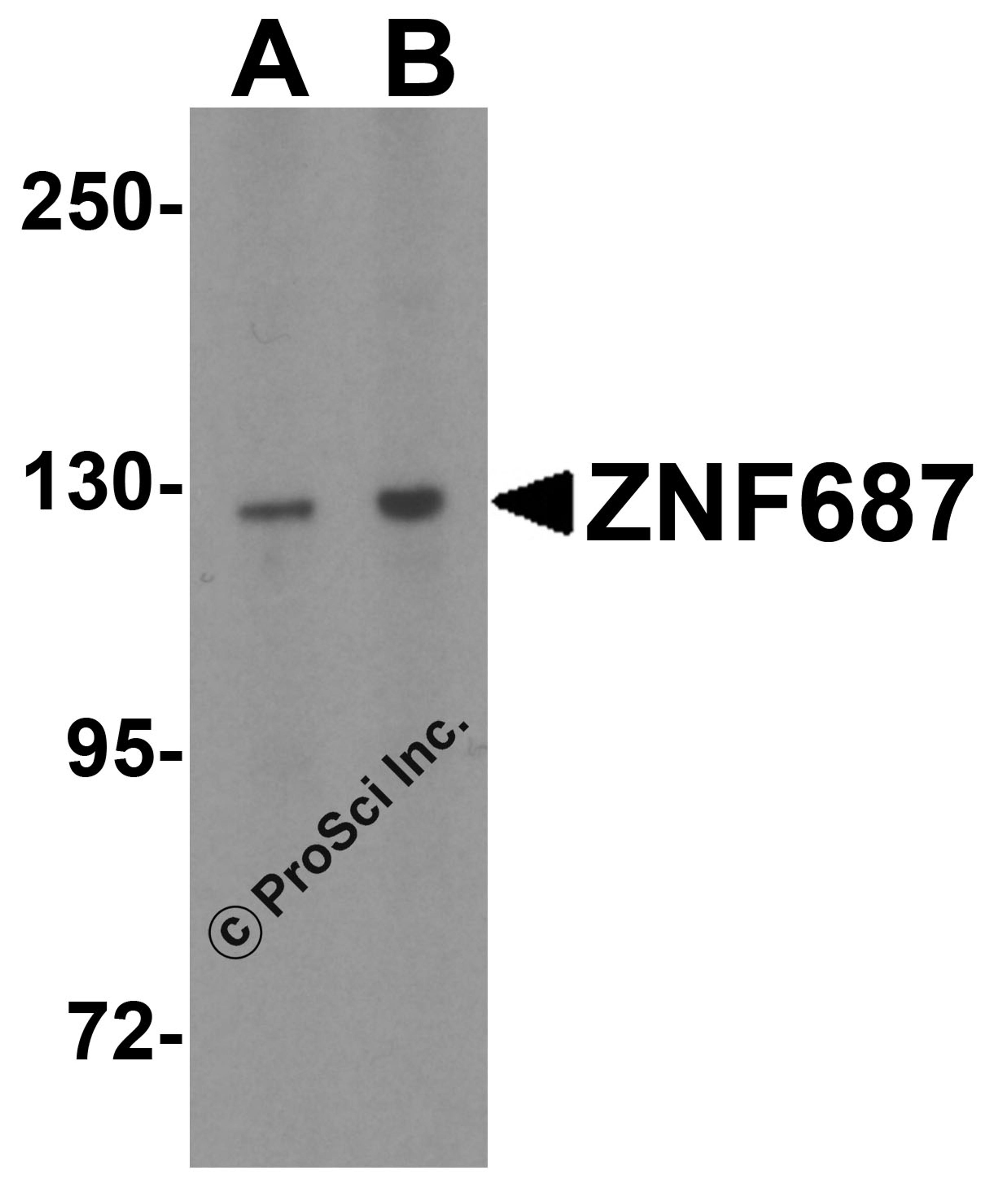 Western blot analysis of ZNF687 in HeLa cell lysate with ZNF687 antibody at (A) 1 and (B) 2 μg/mL.