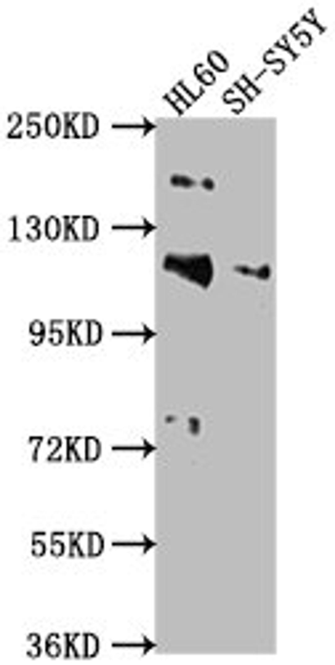 Western Blot. Positive WB detected in: HL60 whole cell lysate, SH-SY5Y whole cell lysate. All lanes: RAPGEF1 antibody at 1:2000. Secondary. Goat polyclonal to rabbit IgG at 1/50000 dilution. Predicted band size: 121, 117, 123 kDa. Observed band size: 121 kDa