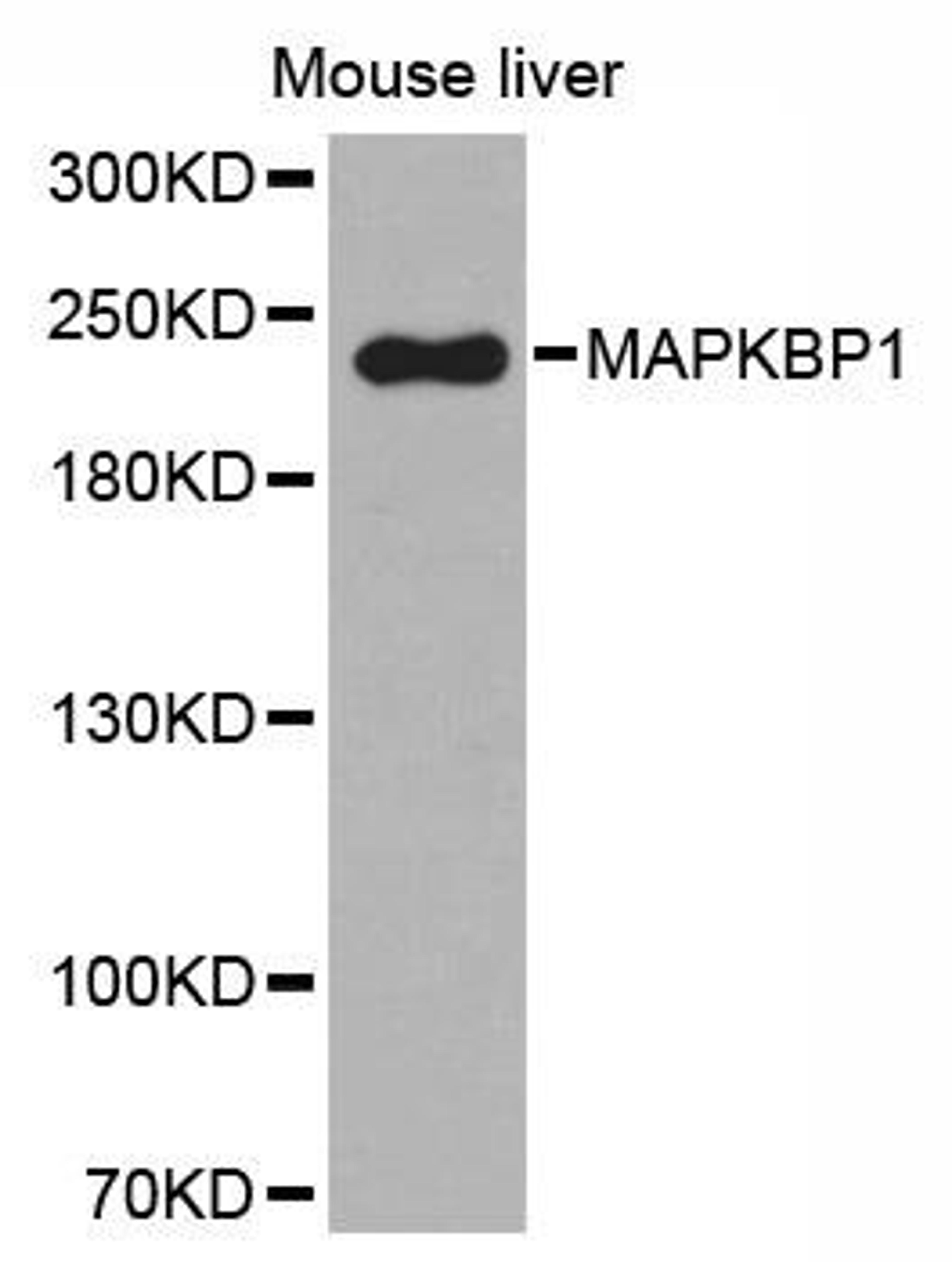 Western blot analysis of extracts of mouse liver tissue using MAPKBP1 antibody