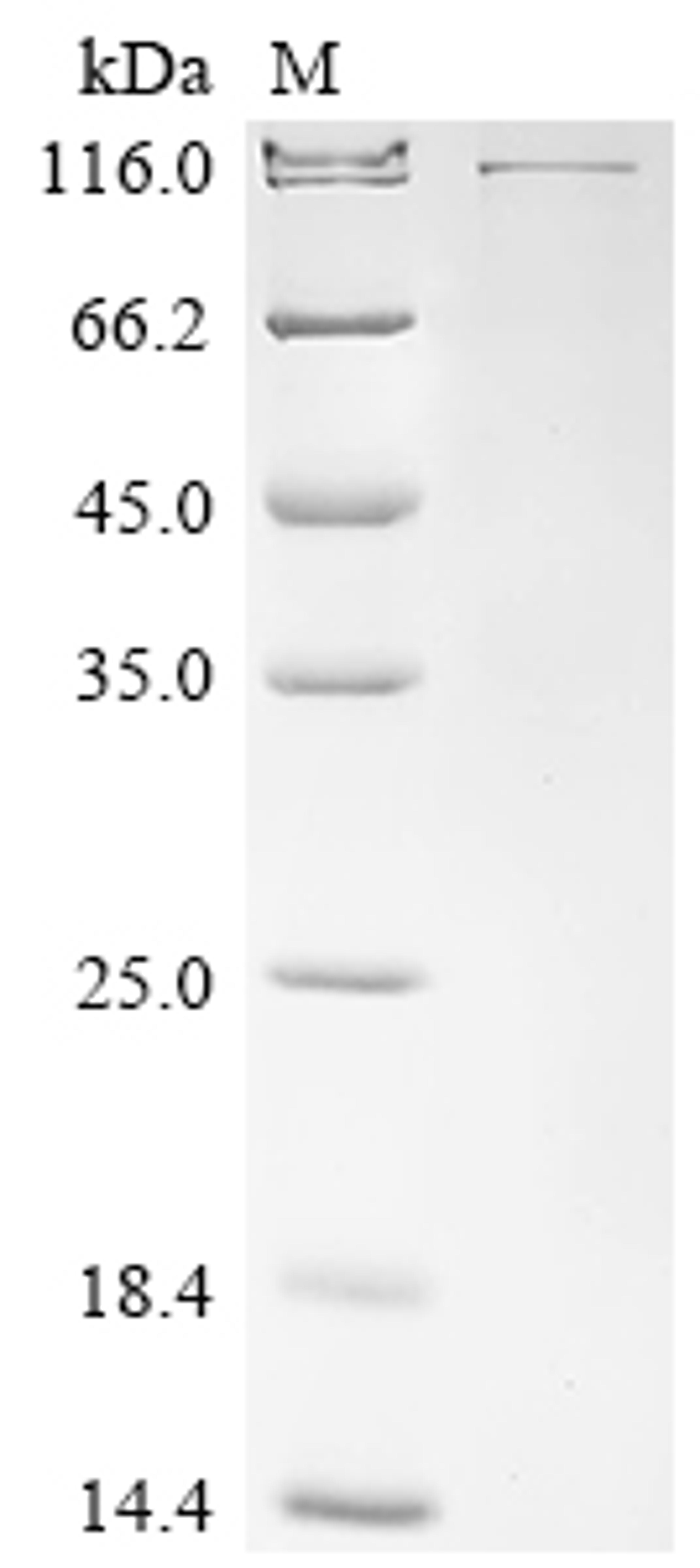 (Tris-Glycine gel) Discontinuous SDS-PAGE (reduced) with 5% enrichment gel and 15% separation gel.