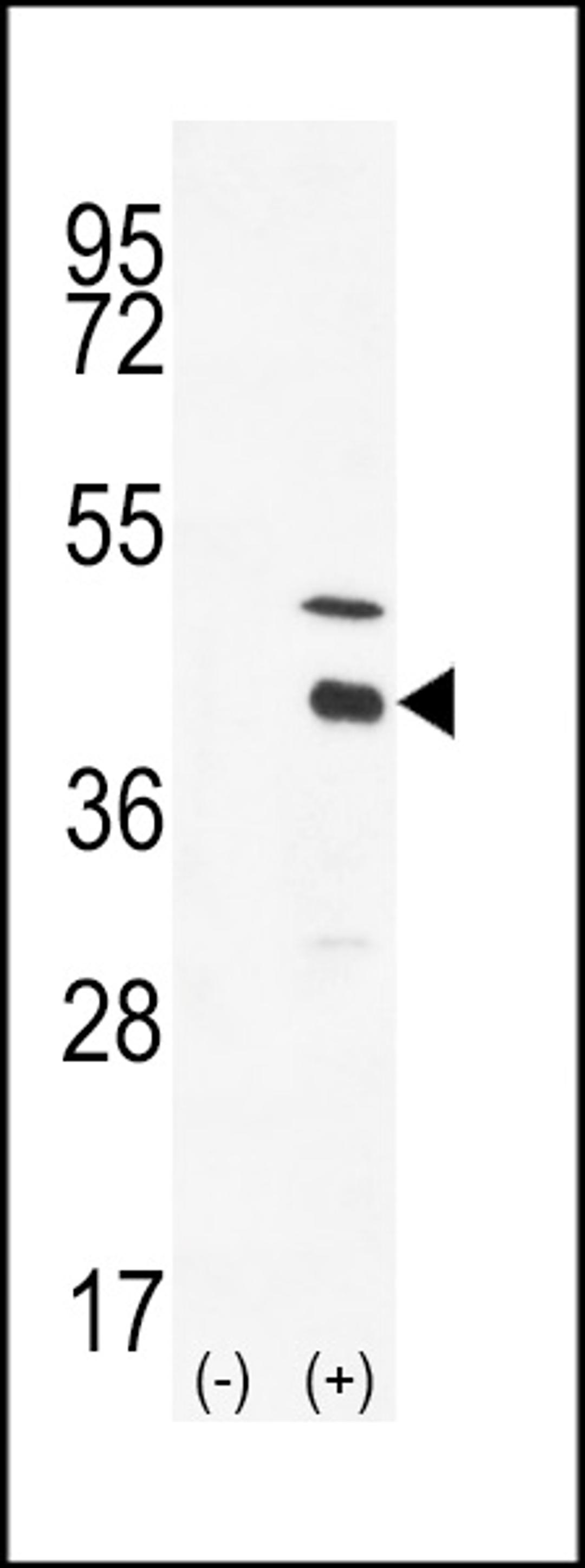 Western blot analysis of DOK4 using DOK4 Antibody using 293 cell lysates (2 ug/lane) either nontransfected (Lane 1) or transiently transfected with the DOK4 gene (Lane 2).