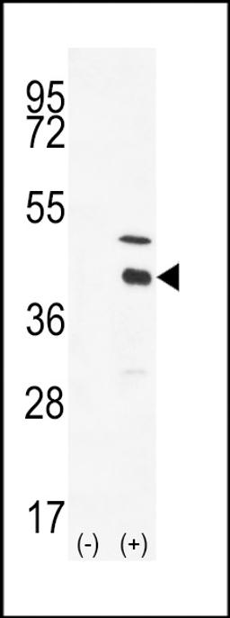 Western blot analysis of DOK4 using DOK4 Antibody using 293 cell lysates (2 ug/lane) either nontransfected (Lane 1) or transiently transfected with the DOK4 gene (Lane 2).