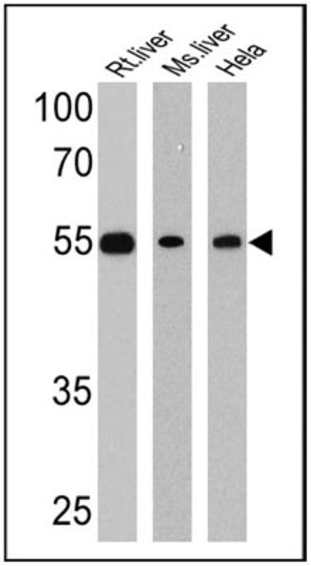 Western Blot: LXR beta/NR1H2 Antibody [NB100-74457] - 25 ug of rat liver (Lane 1), mouse liver (Lane 2) and Hela (Lane 3) cell lysates.