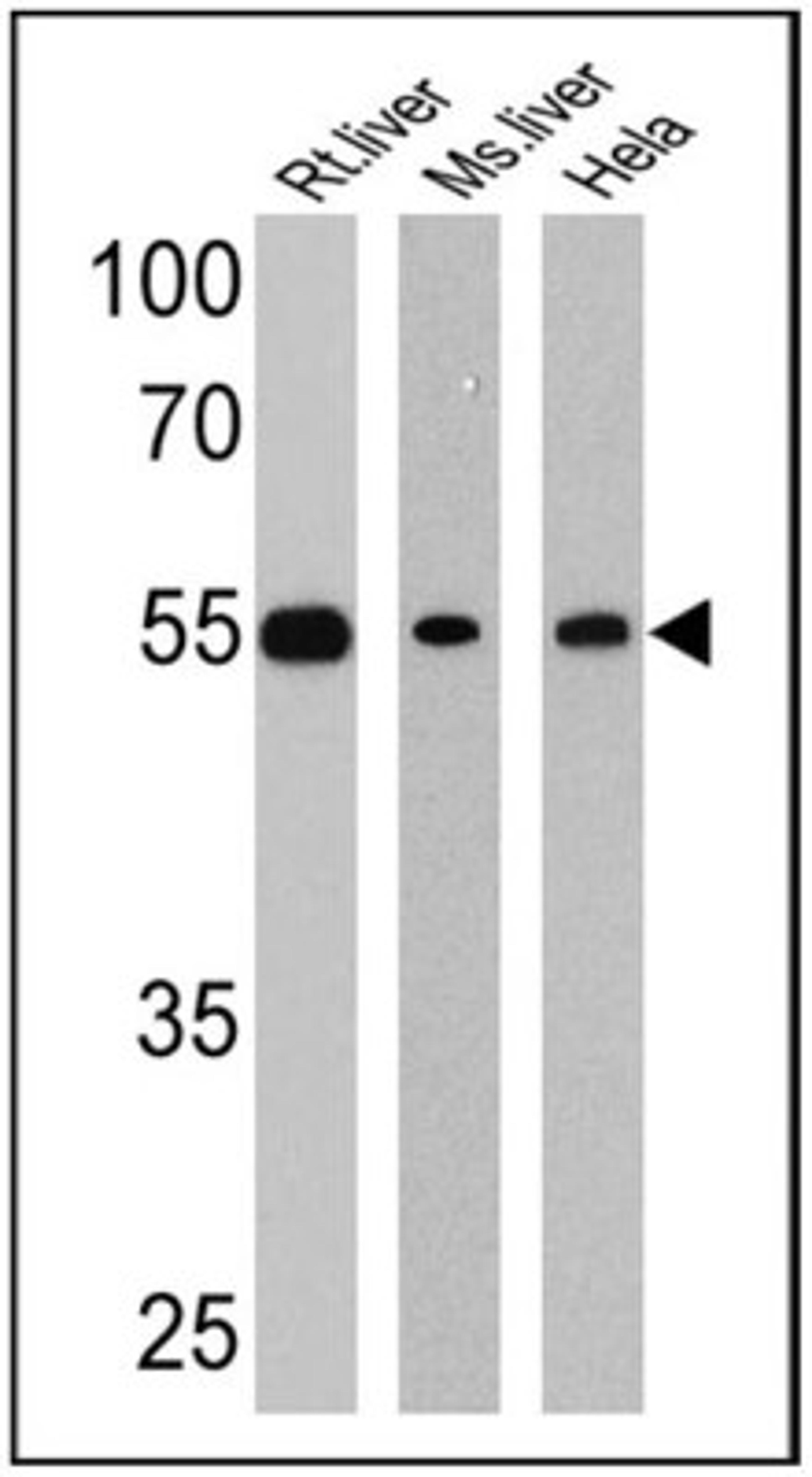 Western Blot: LXR beta/NR1H2 Antibody [NB100-74457] - 25 ug of rat liver (Lane 1), mouse liver (Lane 2) and Hela (Lane 3) cell lysates.