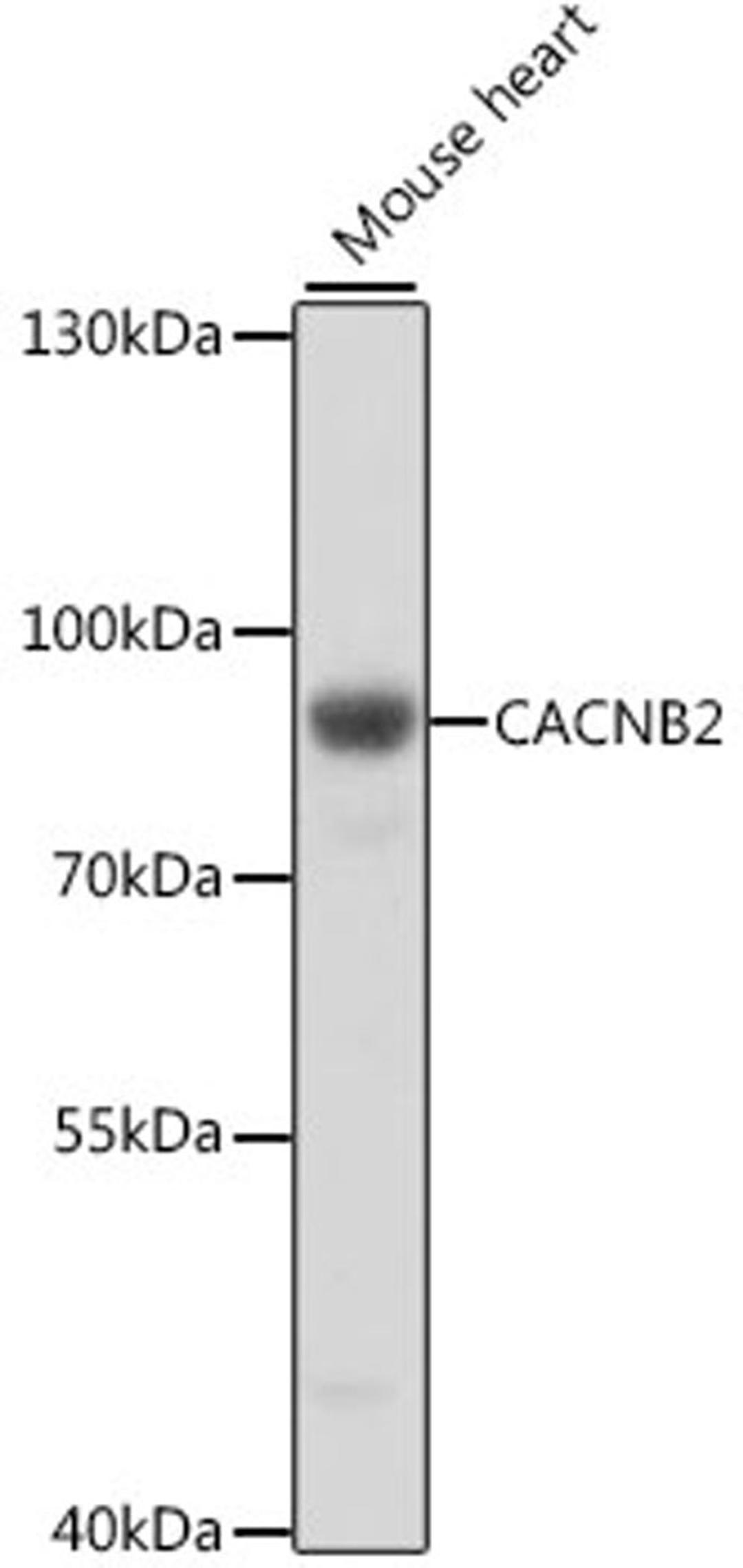 Western blot - CACNB2 antibody (A16037)