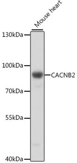 Western blot - CACNB2 antibody (A16037)