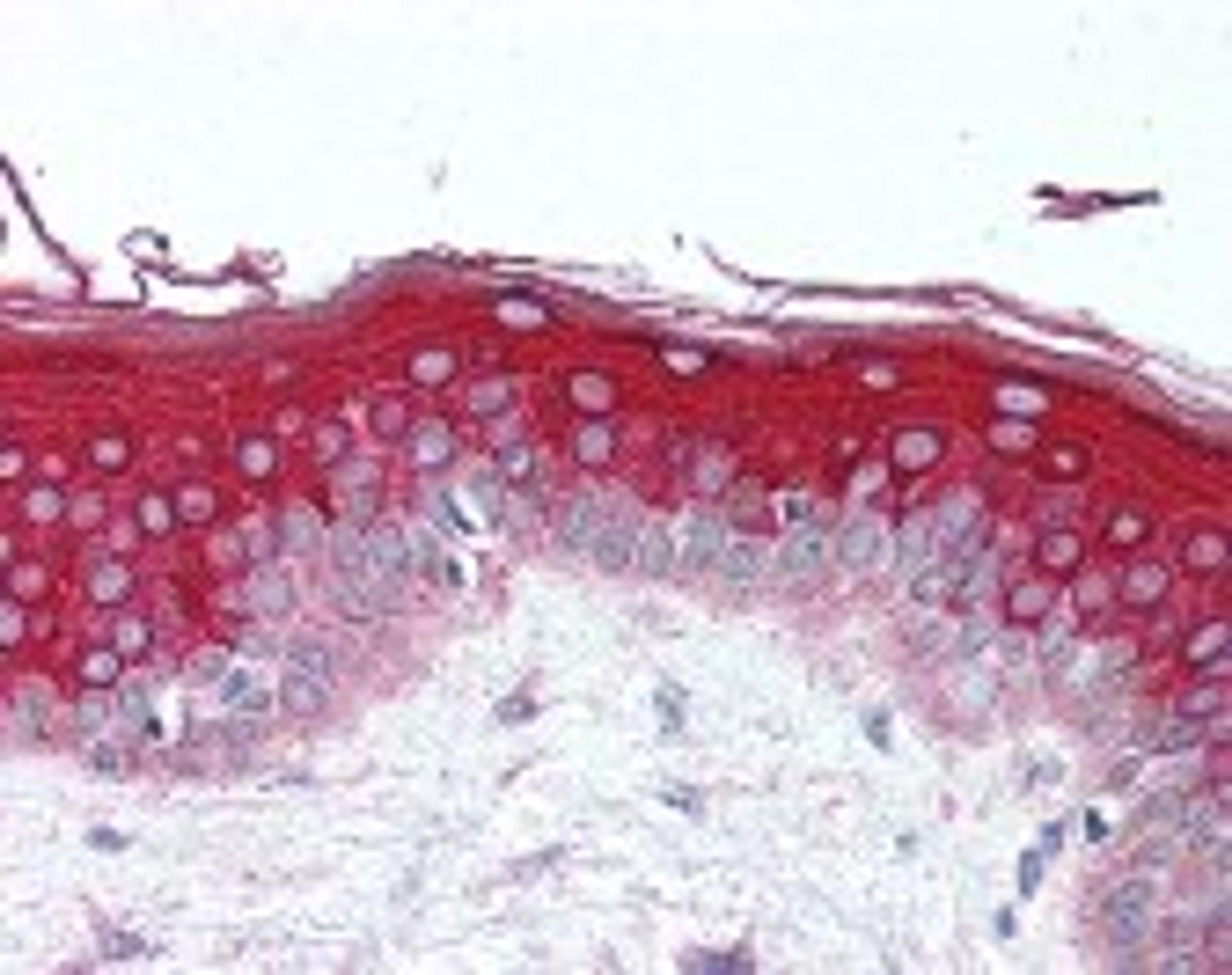 Immunohistochemistry staining of GBL in skin tissue using GBL Antibody.