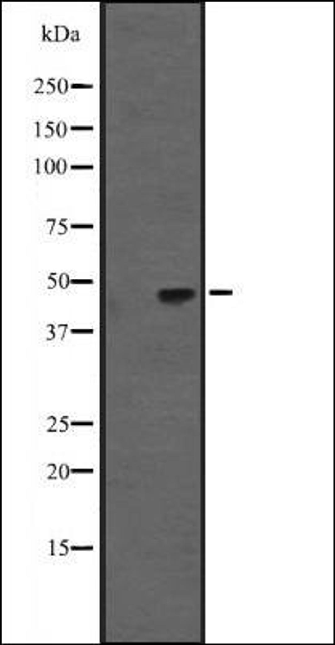 Western blot analysis of Hela cell lysate using KRT31/33A/33B antibody