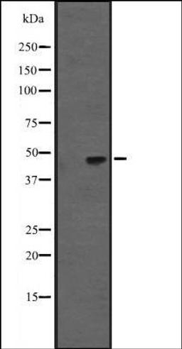 Western blot analysis of Hela cell lysate using KRT31/33A/33B antibody