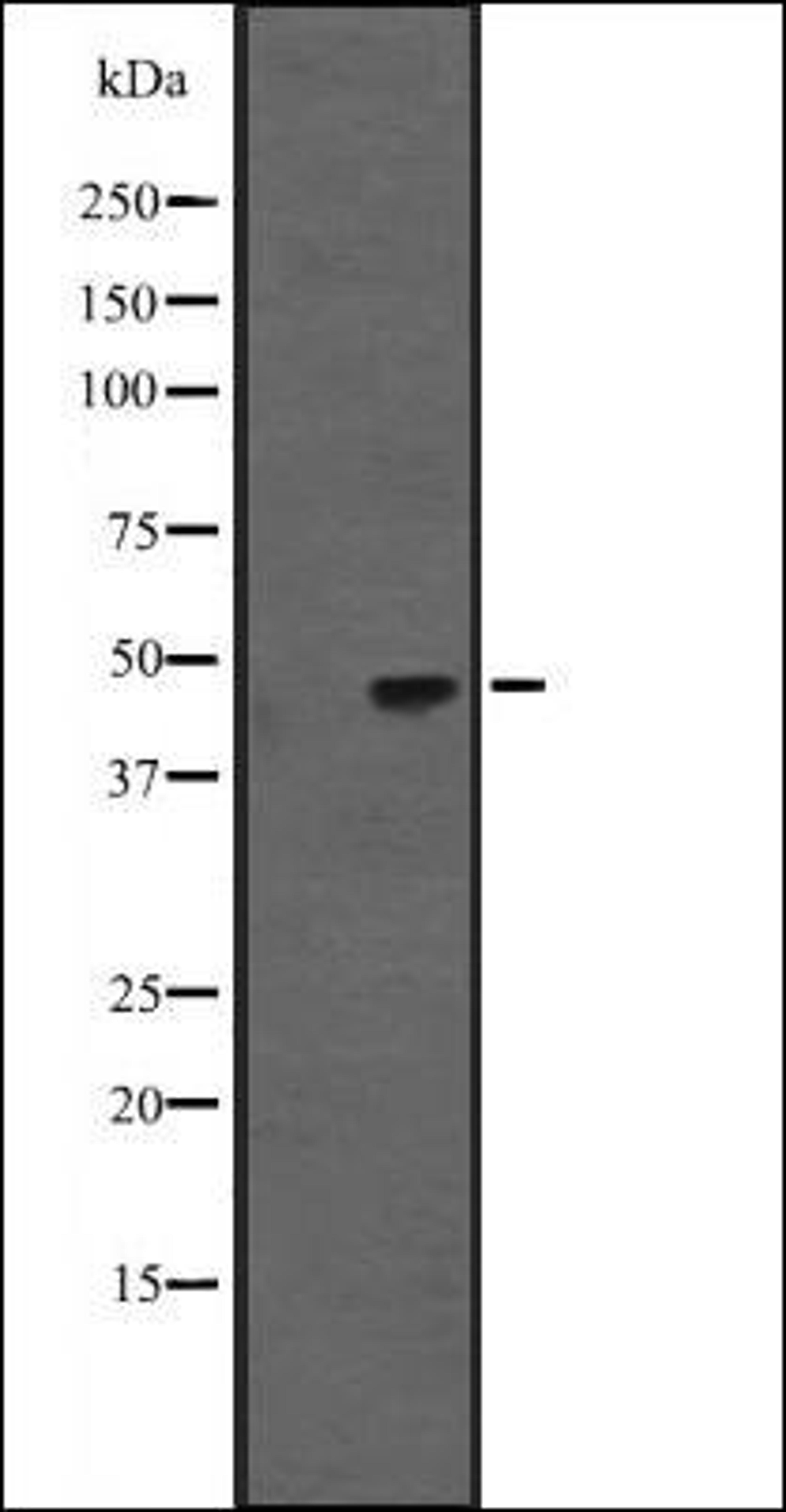 Western blot analysis of Hela cell lysate using KRT31/33A/33B antibody