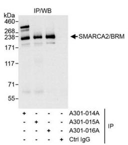 Detection of human SMARCA2/BRM by western blot of immunoprecipitates.