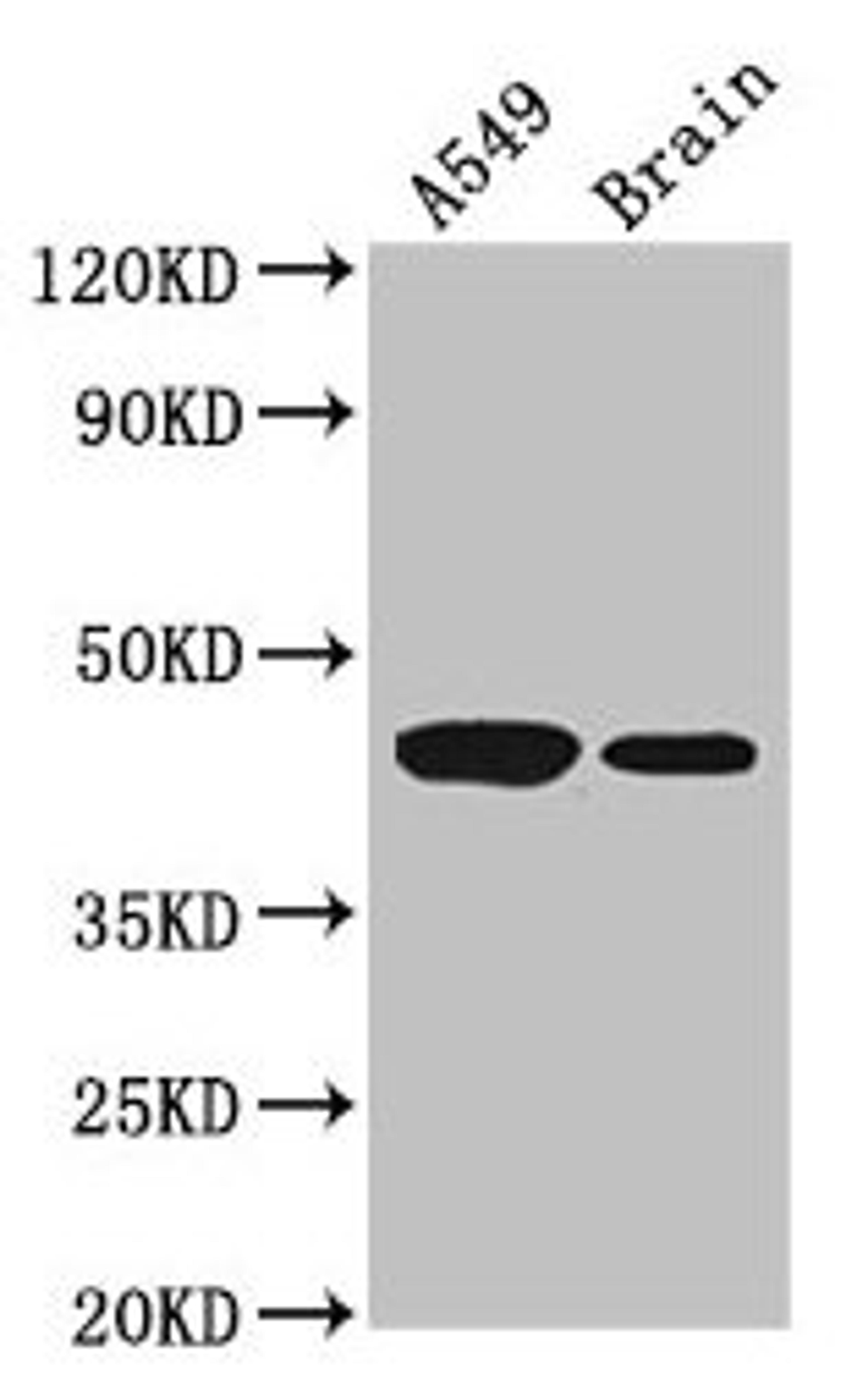 Western Blot. Positive WB detected in: A549 whole cell lysate, Mouse brain tissue. All lanes: AMT antibody at 3.5µg/ml. Secondary. Goat polyclonal to rabbit IgG at 1/50000 dilution. Predicted band size: 44, 38, 40, 42 kDa. Observed band size: 44 kDa