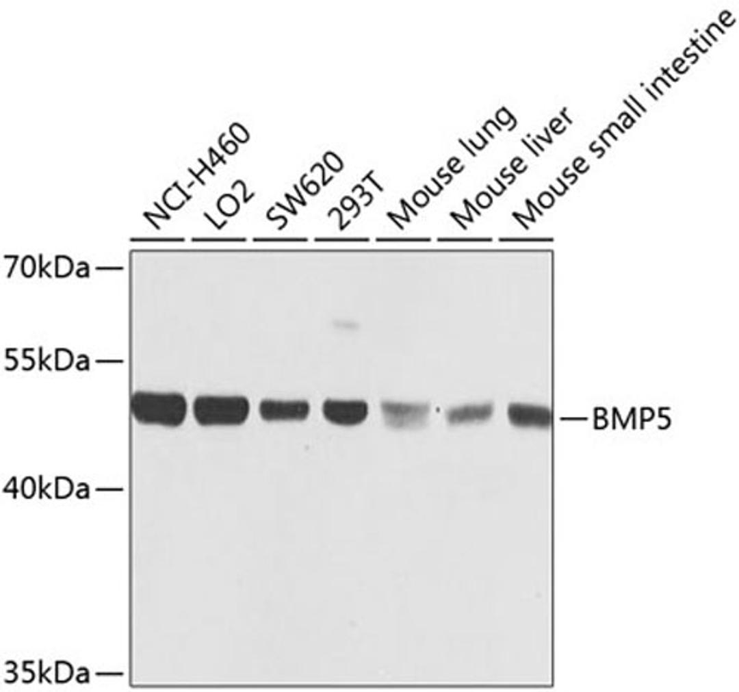 Western blot - BMP5 antibody (A8401)