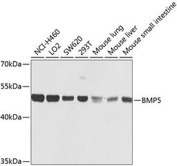 Western blot - BMP5 antibody (A8401)