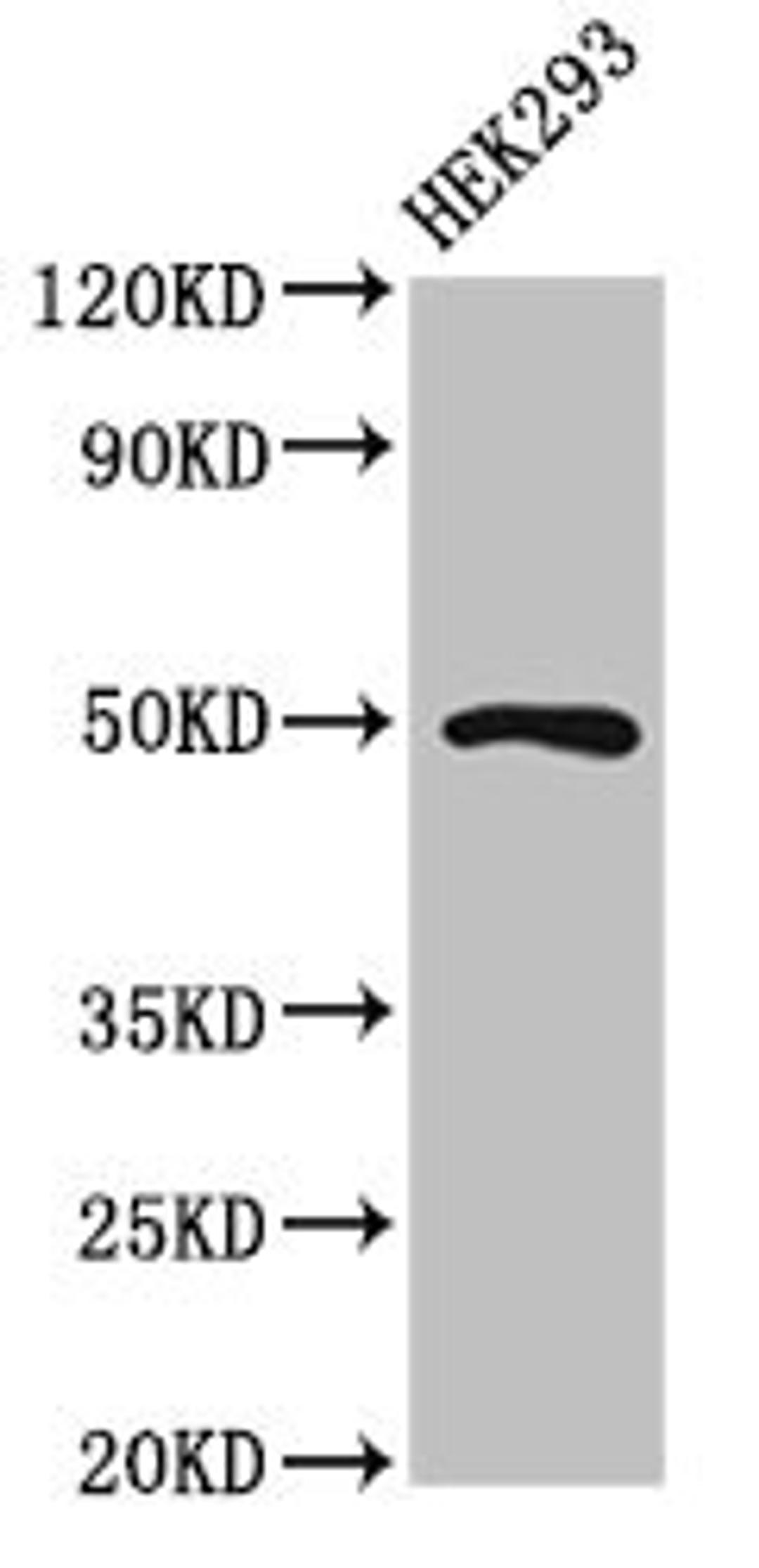 Western Blot. Positive WB detected in: HEK293 whole cell lysate. All lanes: MNX1 antibody at 2µg/ml. Secondary. Goat polyclonal to rabbit IgG at 1/50000 dilution. Predicted band size: 41, 21 kDa. Observed band size: 50 kDa