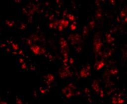 Immunocytochemistry/Immunofluorescence: CUEDC1 Antibody [NBP1-76946] - Immunofluorescence of CUEDC1 in human liver tissue with CUEDC1 antibody at 20 ug/mL.