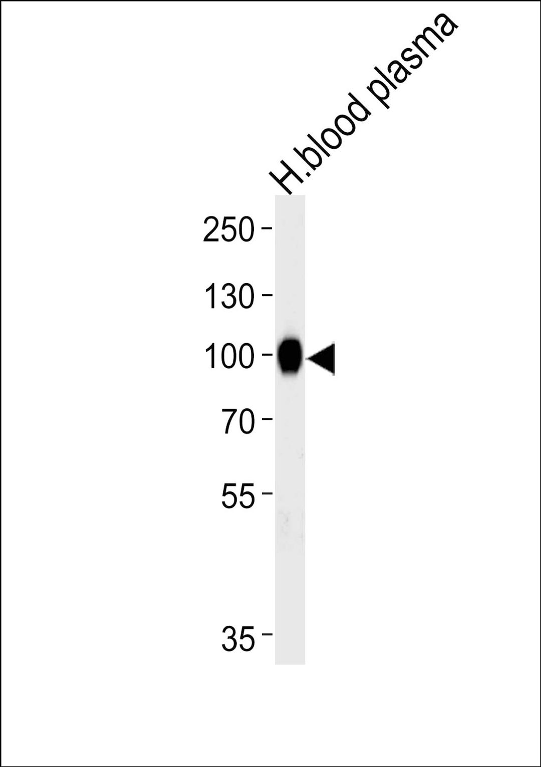 Western blot analysis of lysate from human blood plasma tissue lysate, using PLG Antibody at 1:1000 at each lane.