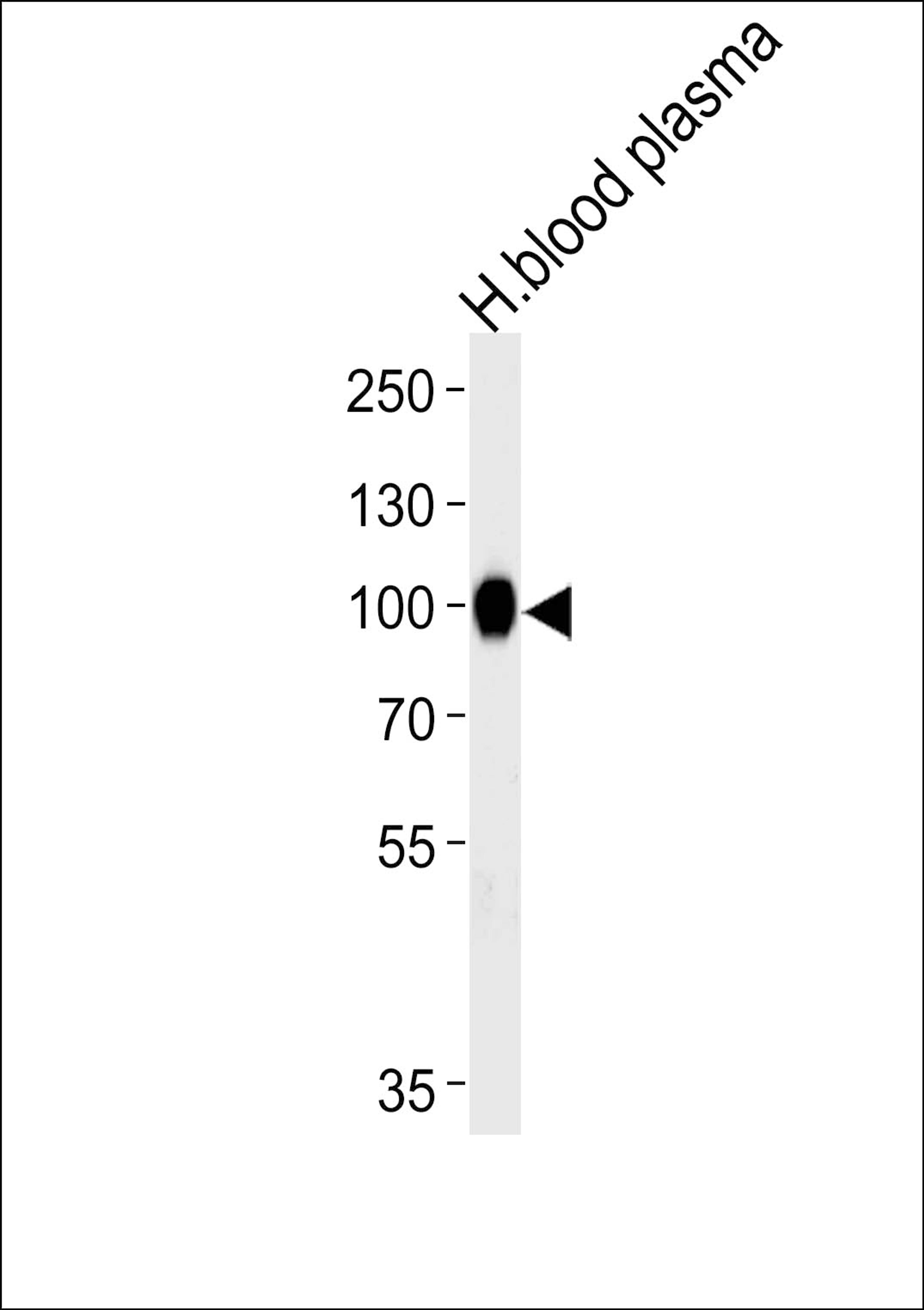 Western blot analysis of lysate from human blood plasma tissue lysate, using PLG Antibody at 1:1000 at each lane.