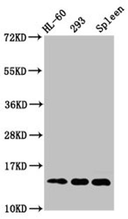 Western Blot. Positive WB detected in: HL60 whole cell lysate, 293 whole cell lysate, Rat spleen tissue. All lanes: HIST1H2BC antibody at 1µg/ml. Secondary. Goat polyclonal to rabbit IgG at 1/50000 dilution. Predicted band size: 14 kDa. Observed band size: 14 kDa