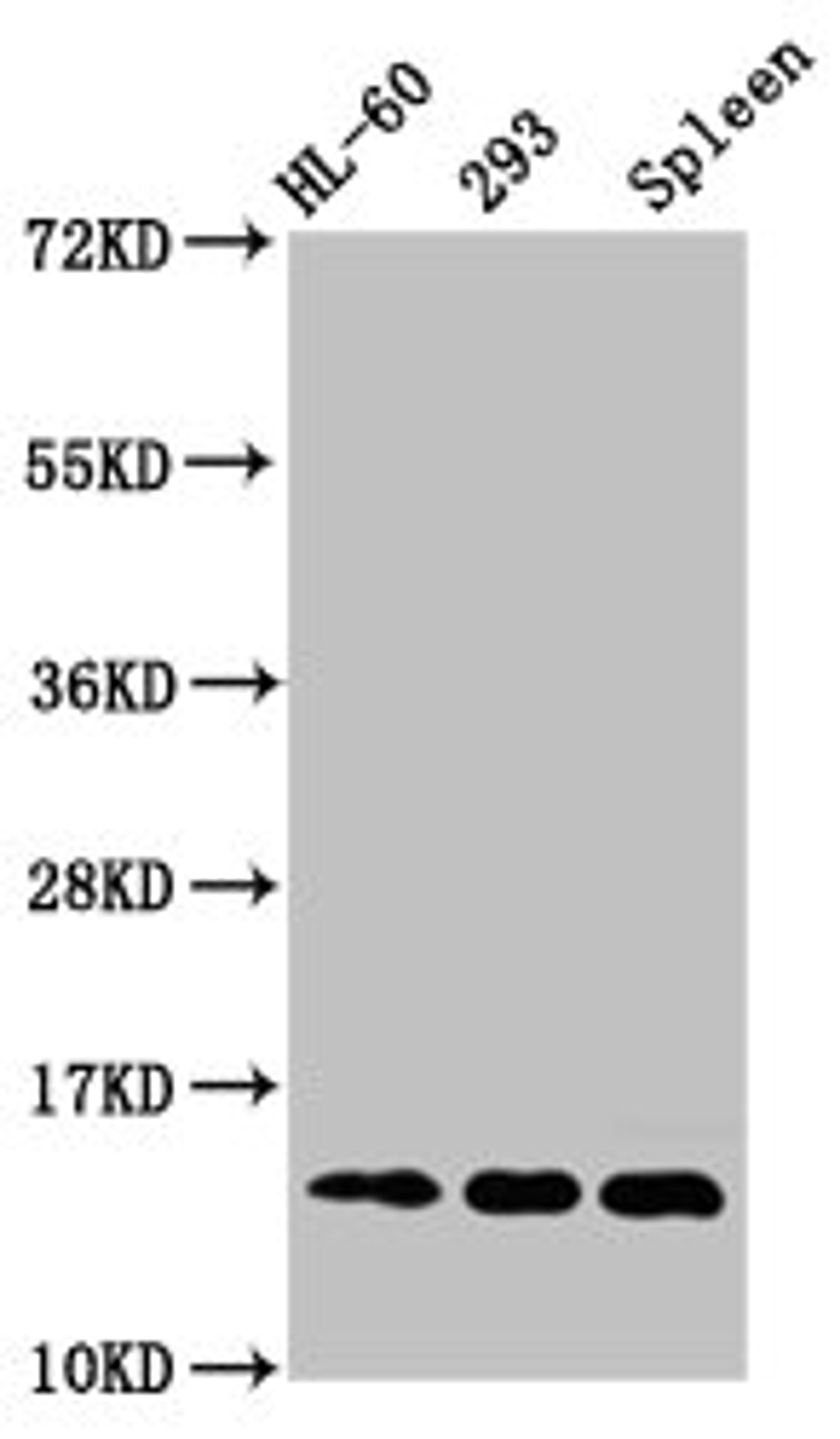 Western Blot. Positive WB detected in: HL60 whole cell lysate, 293 whole cell lysate, Rat spleen tissue. All lanes: HIST1H2BC antibody at 1µg/ml. Secondary. Goat polyclonal to rabbit IgG at 1/50000 dilution. Predicted band size: 14 kDa. Observed band size: 14 kDa