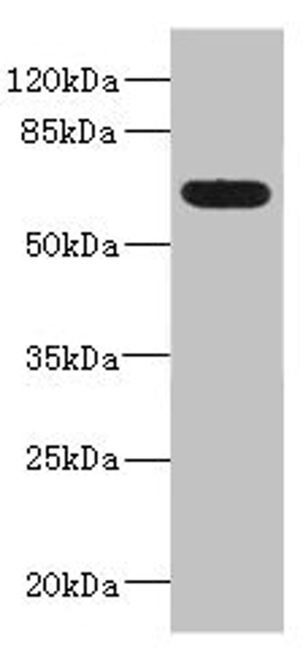 Western blot. All lanes: ALCAMantibody IgG at 5.36ug/ml + Mouse kidney tissue. Secondary. Goat polyclonal to rabbit IgG at 1/10000 dilution. Predicted band size: 66, 64, 16, 34 kDa. Observed band size: 66 kDa.