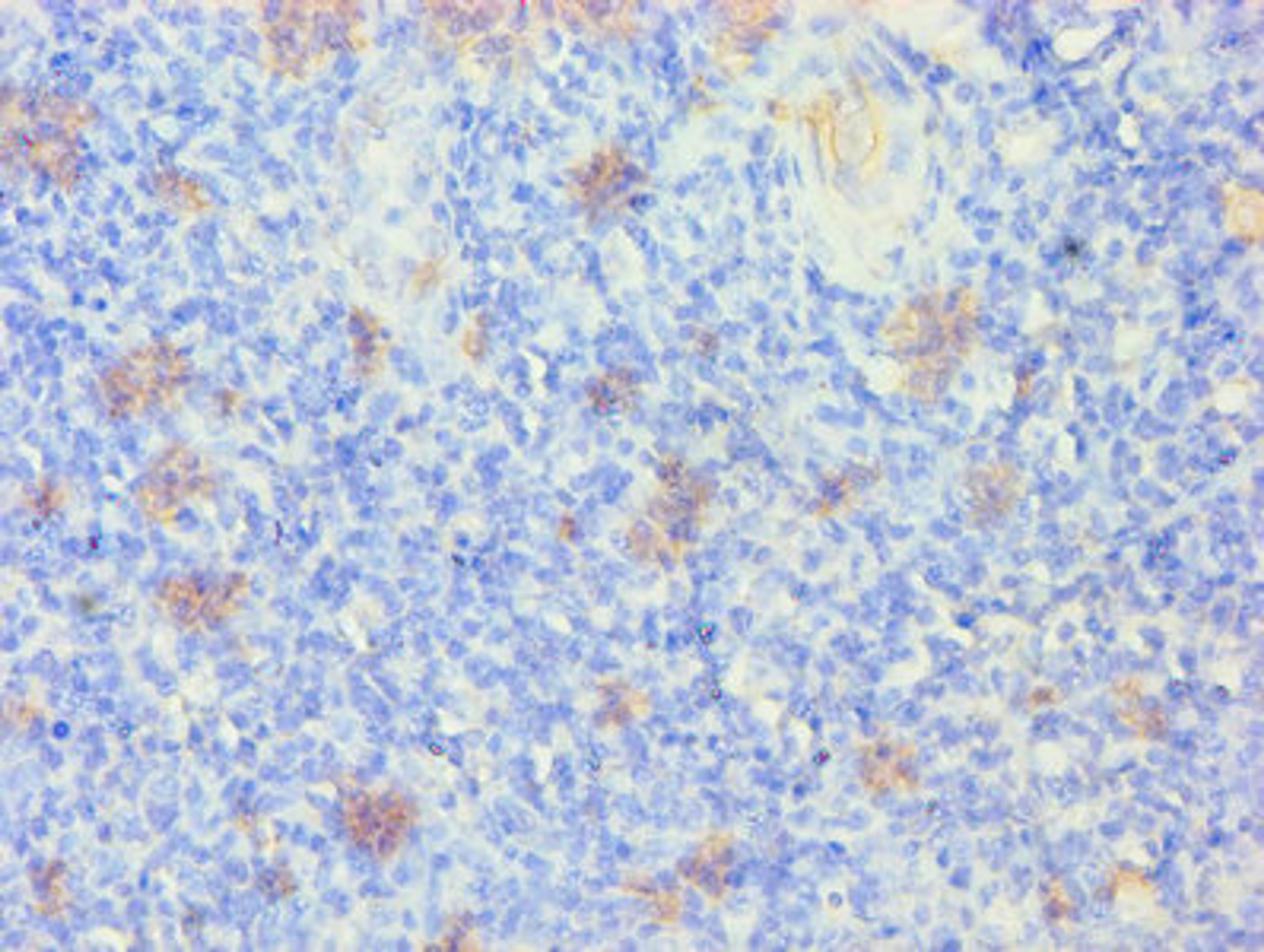 Immunohistochemistry of paraffin-embedded human tonsil tissue using CSB-PA012512LA01HU at dilution of 1:100