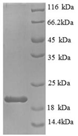 (Tris-Glycine gel) Discontinuous SDS-PAGE (reduced) with 5% enrichment gel and 15% separation gel.