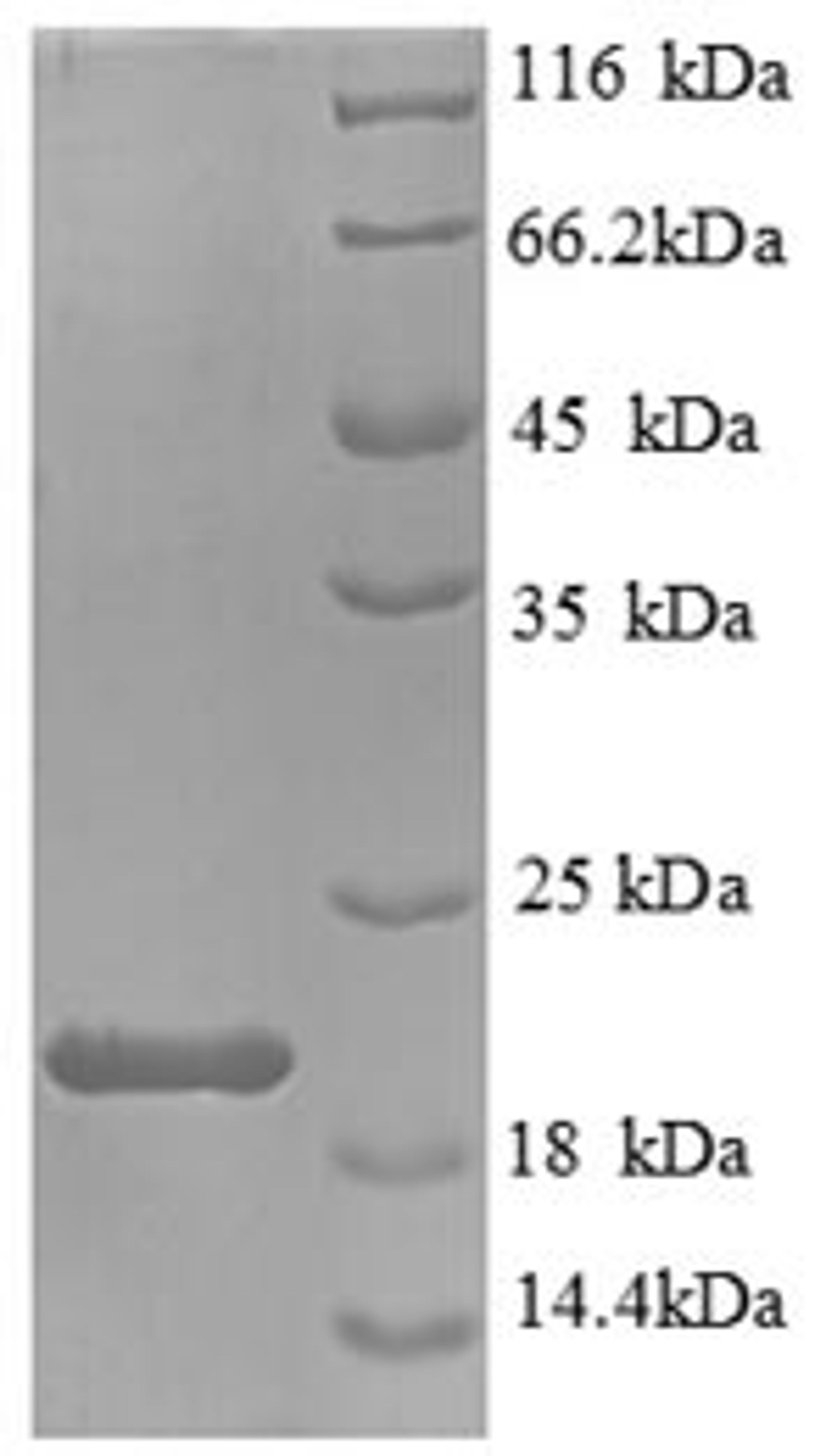 (Tris-Glycine gel) Discontinuous SDS-PAGE (reduced) with 5% enrichment gel and 15% separation gel.