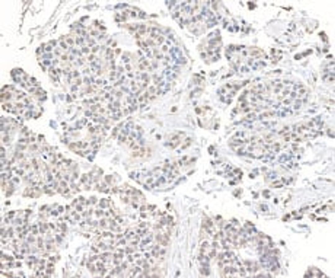 Detection of human CHD8 by immunohistochemistry.