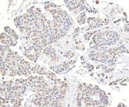 Detection of human CHD8 by immunohistochemistry.