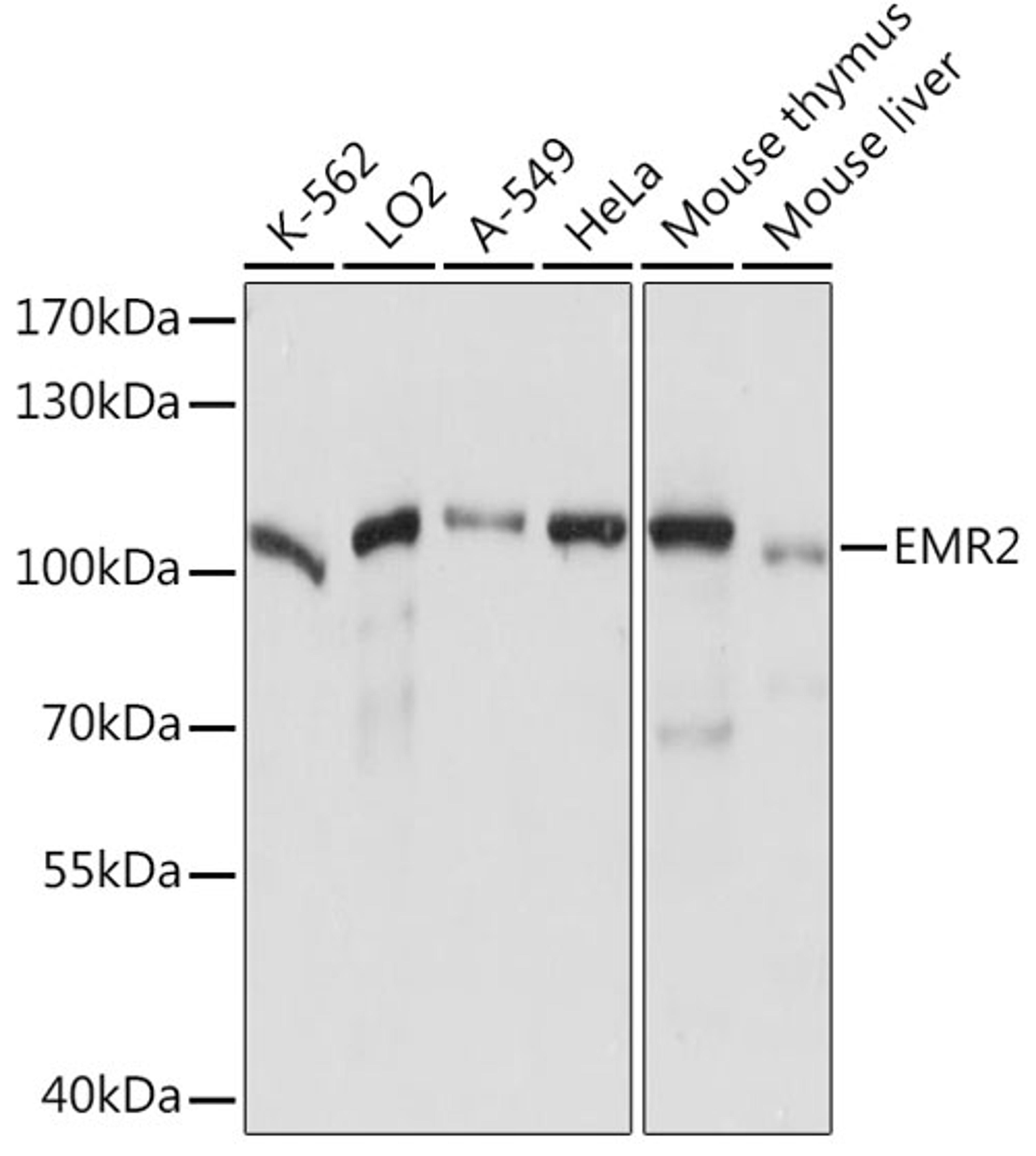 Western blot - EMR2 Rabbit pAb (A14278)