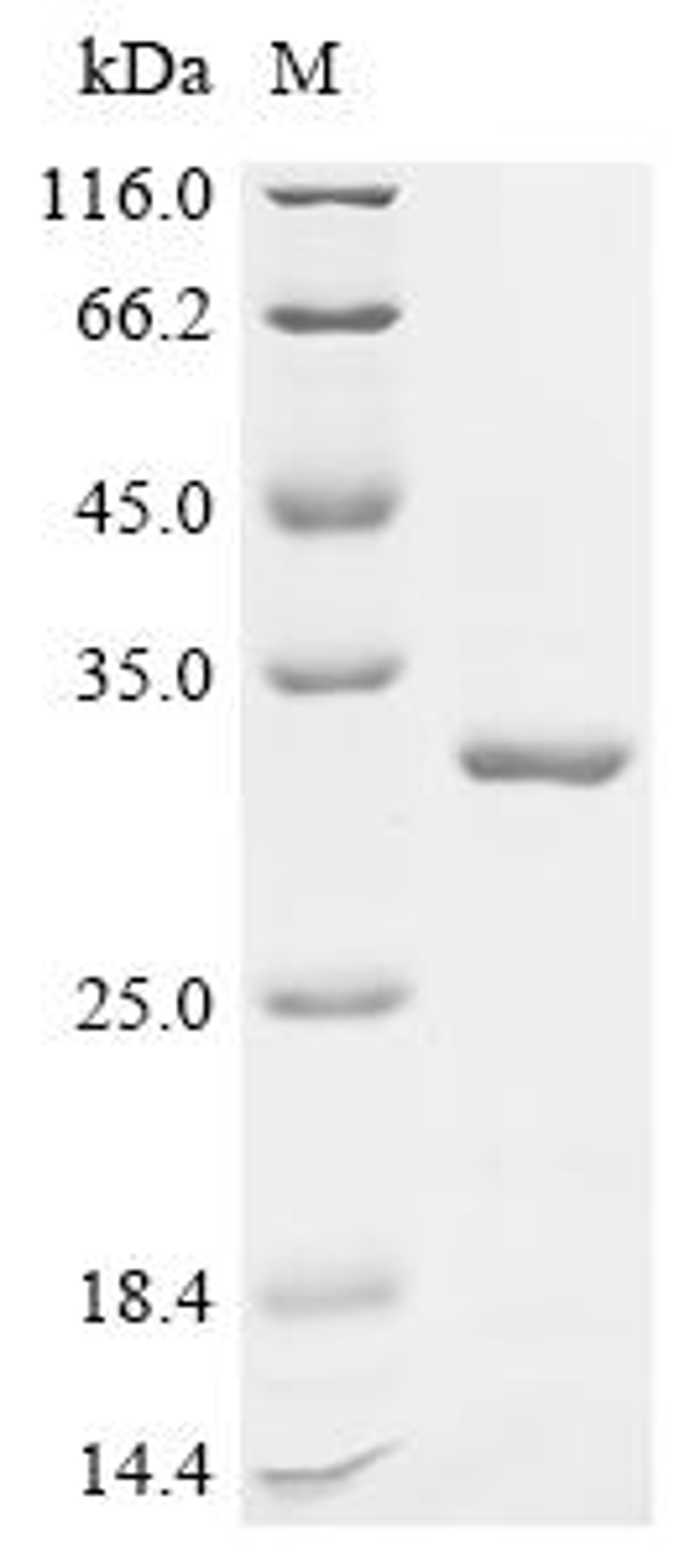 (Tris-Glycine gel) Discontinuous SDS-PAGE (reduced) with 5% enrichment gel and 15% separation gel.