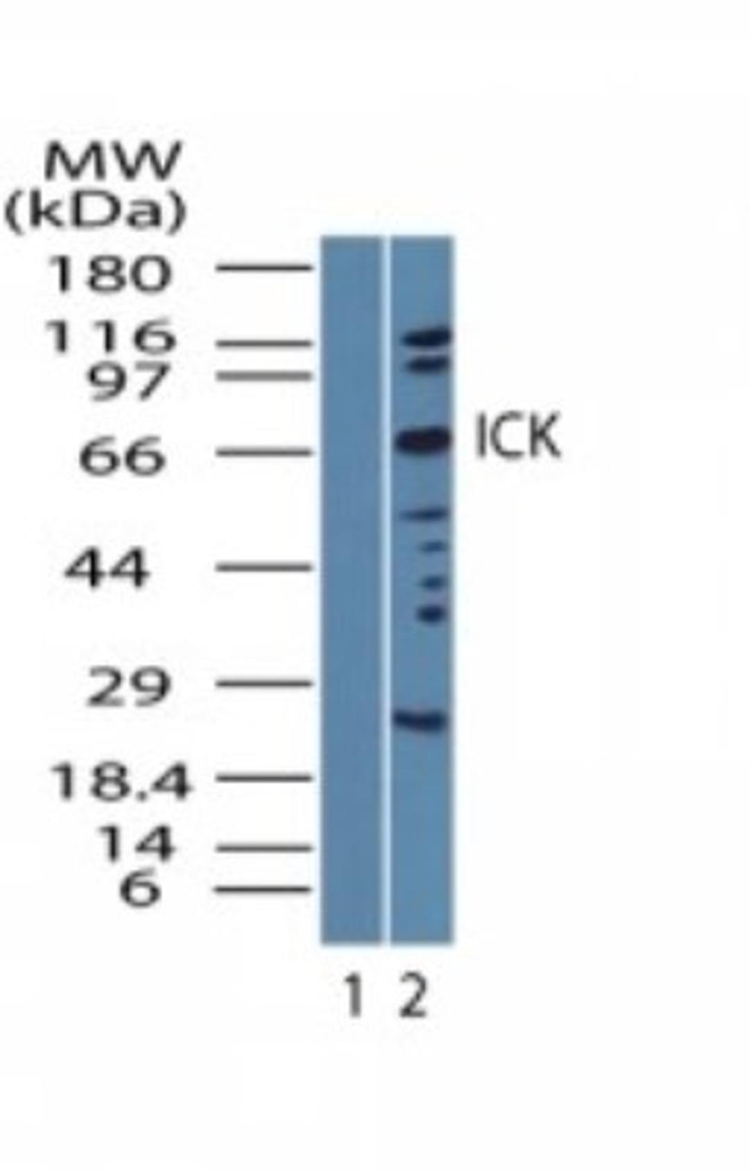 Western Blot: ICK Antibody [NBP2-23656] - Analysis of ICK in HeLa cell lysate. Lane 1 shows pre-immune sera. Lane 2 shows NBP2-23656 tested at 1:5000 dilution.