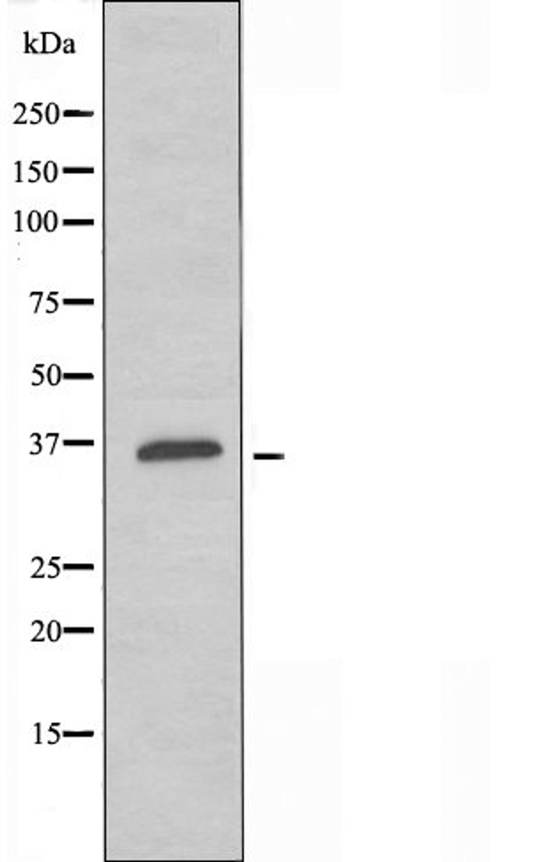 Western blot analysis of COLO cells using OR10G6 antibody