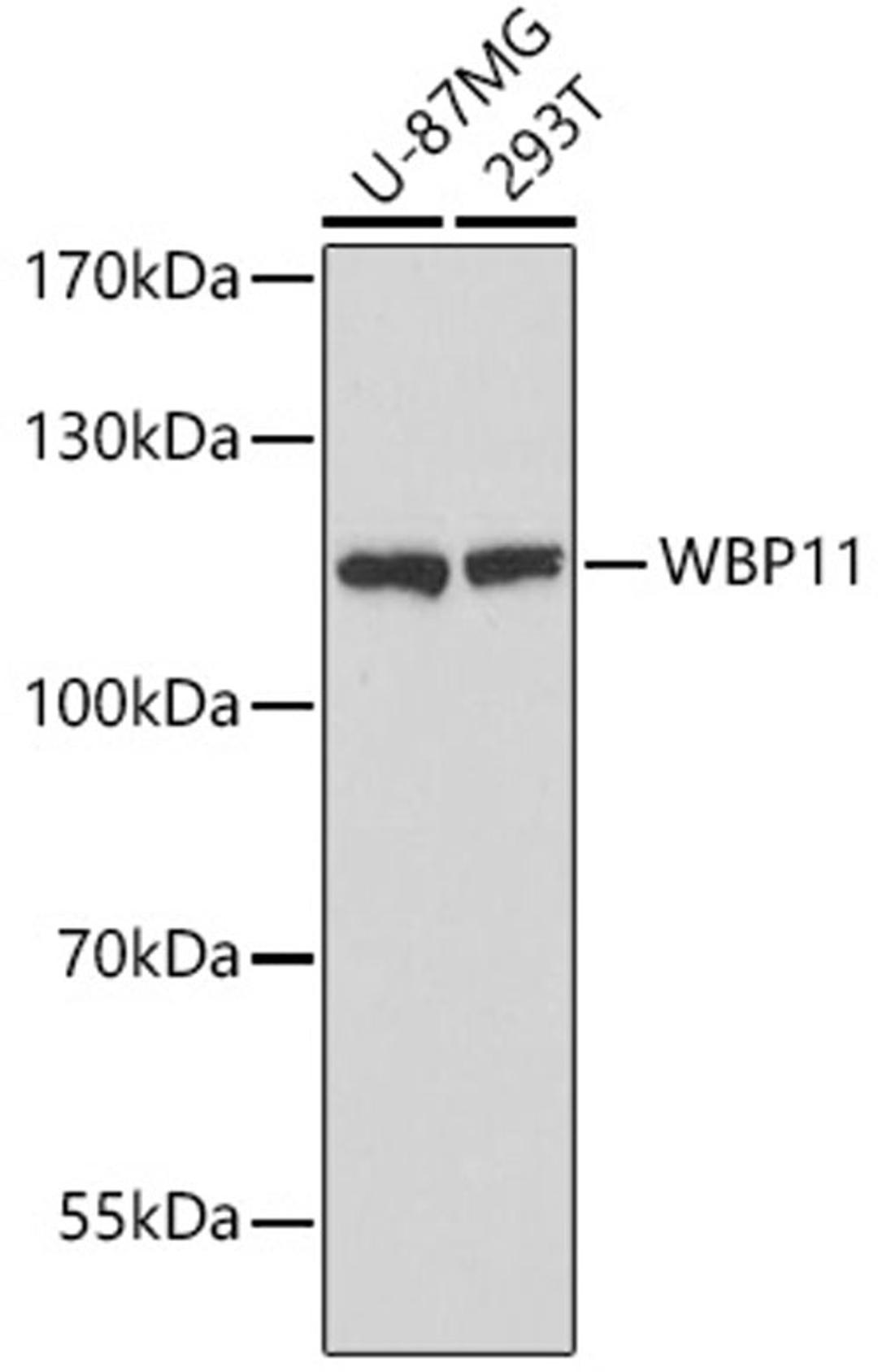 Western blot - WBP11 antibody (A16191)