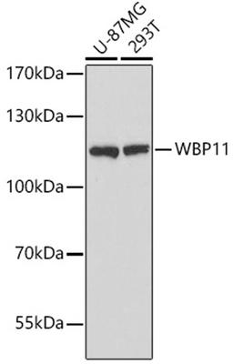 Western blot - WBP11 antibody (A16191)