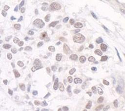 Detection of human GTF3C3/TFIIIC102 by immunohistochemistry.